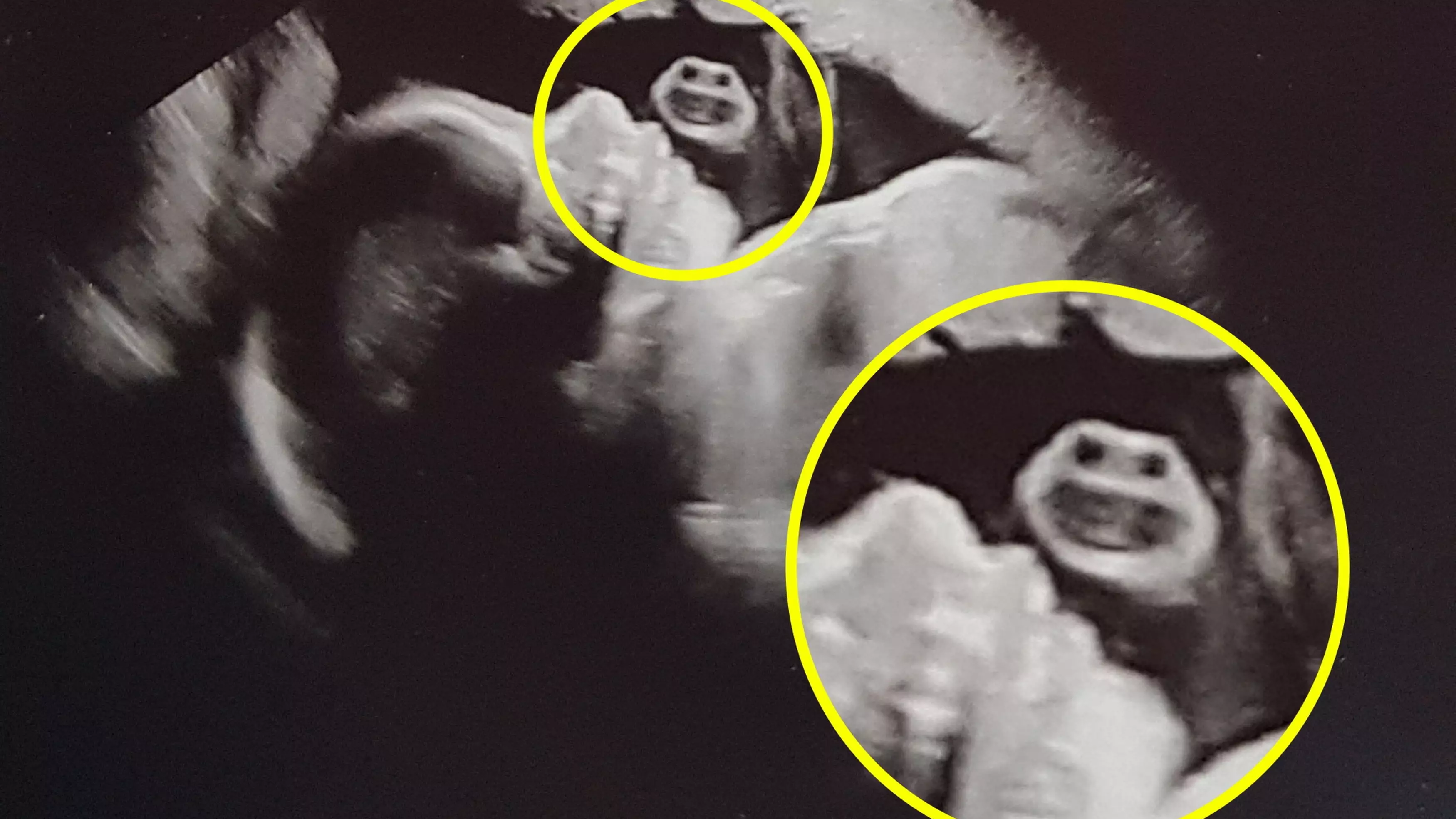 Mum Finds Sugar Puffs Cereal 'Honey Monster' Mascot In Baby Scan