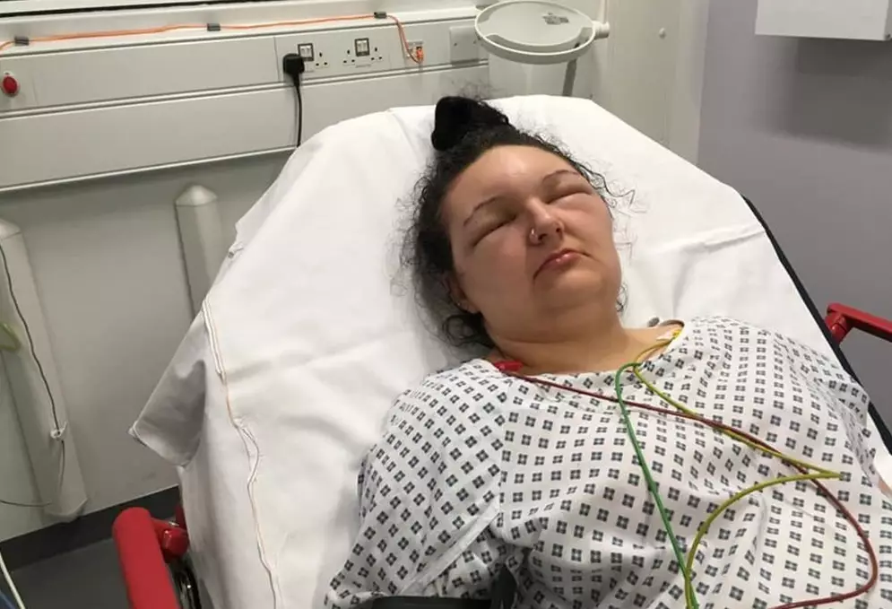 The 18-year-old had to go into hospital for treatment.
