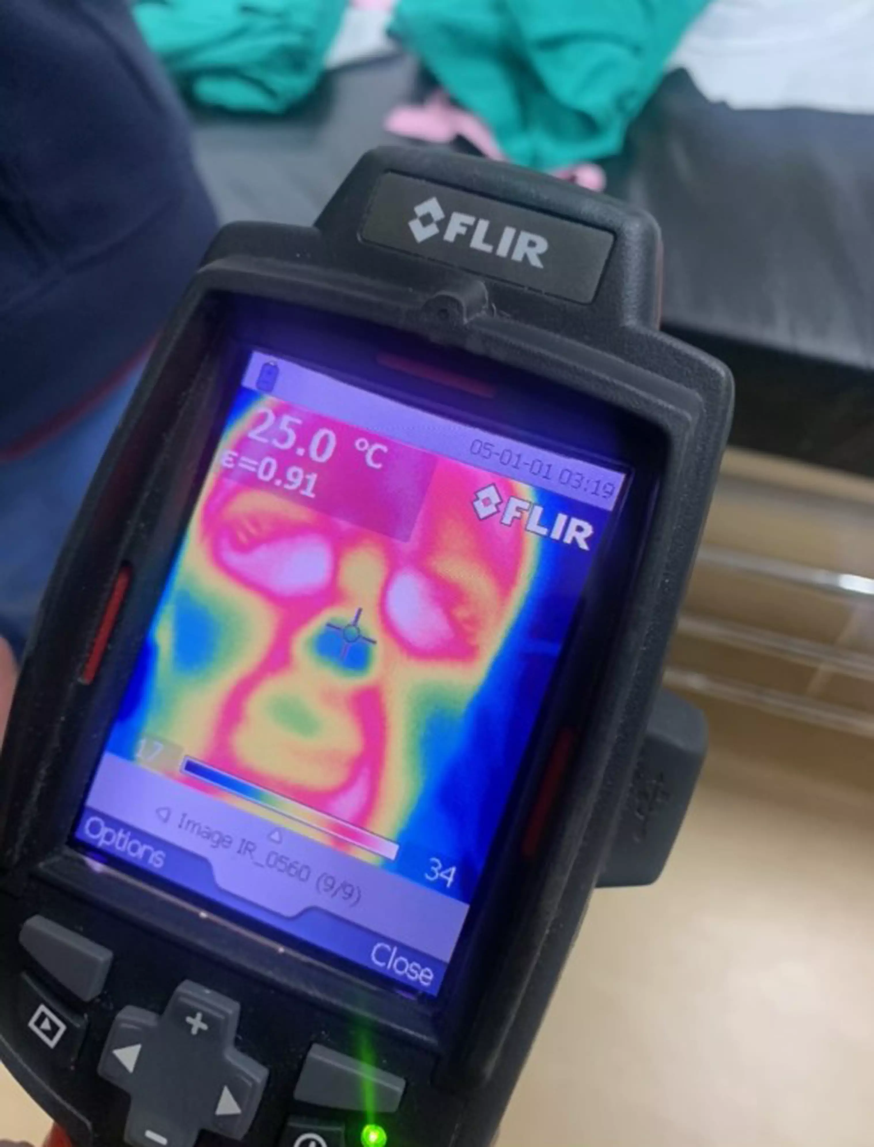 Thermal imaging showed that no blood was reaching the nose (