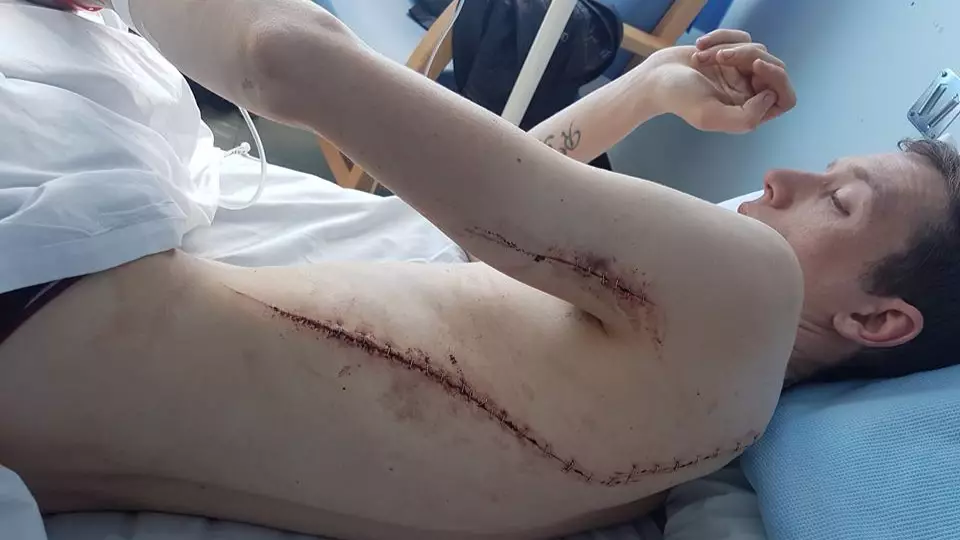 Man Shares Horrific Images He Sustained From A Street Attack
