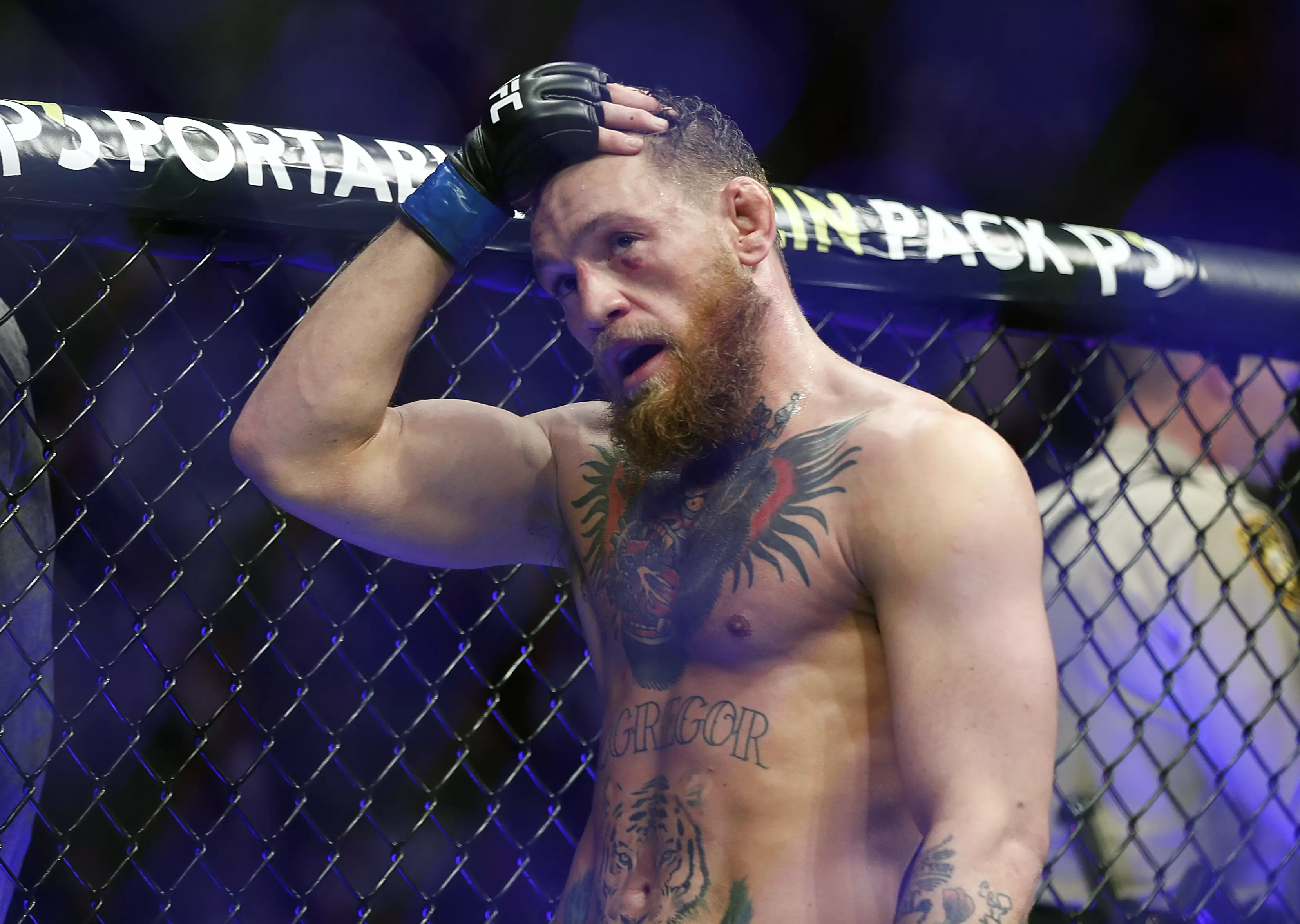 Clearly McGregor's injury was from Khabib as he's already showing signs of the black eye post fight. Image: PA Images