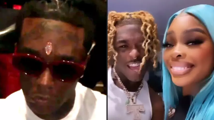 Rapper Lil Uzi Vert Has Removed The $24 Million Diamond From His Forehead
