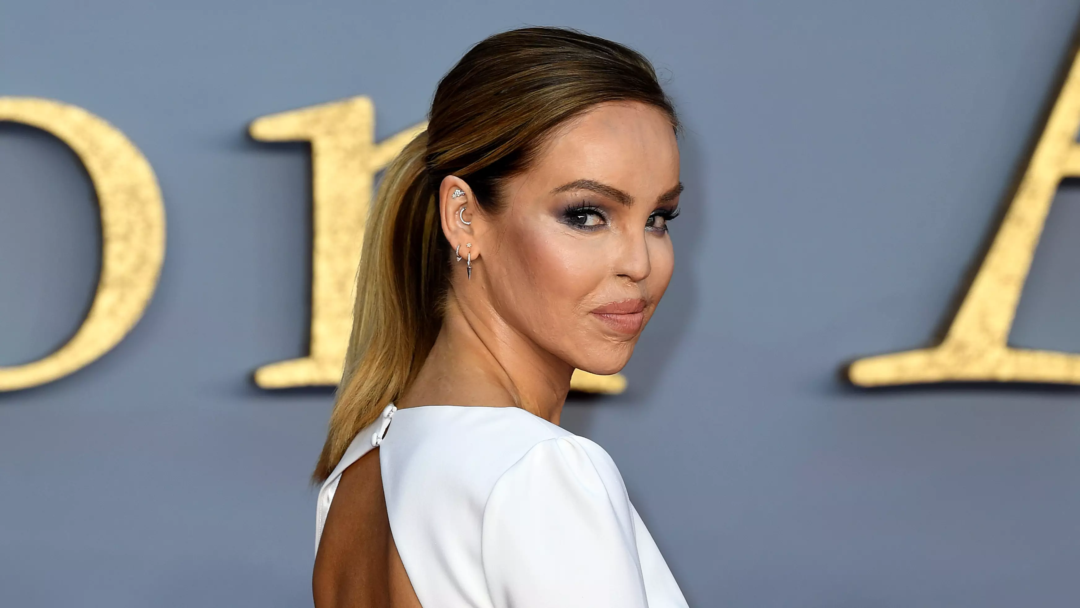 Katie Piper Posts Harrowing Photo Of Her Acid Attack Injuries To Raise Awareness About Mental Health