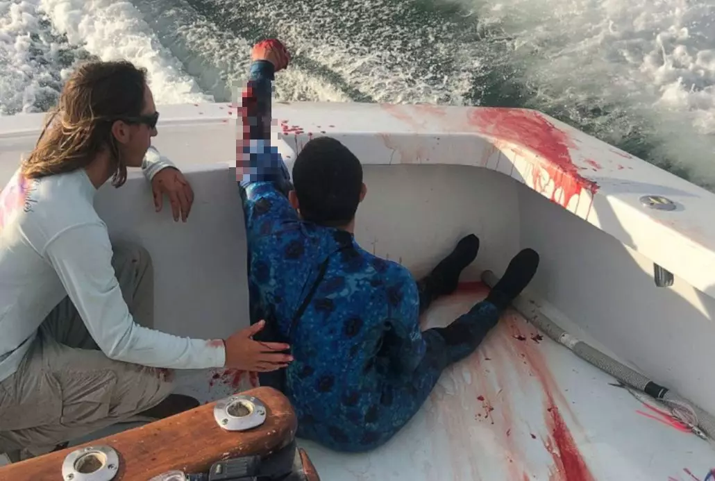 The 40-year-old man climbed onto a boat after being bitten by a shark.