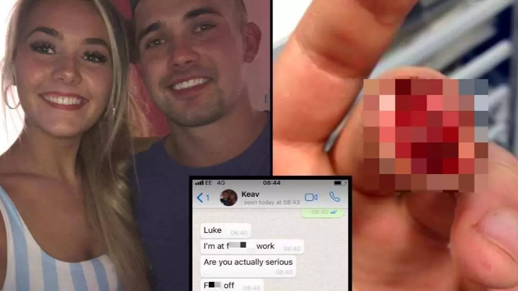 Man Pulls Ultimate April Fool's On Girlfriend With Severed Finger Prank