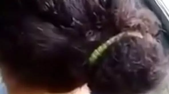 Woman Filmed On Bus With Head Lice Crawling Through Her Hair