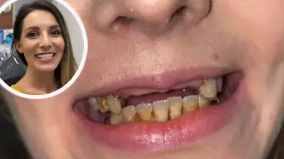 Dentist Repairs Woman's Teeth After She Hid Her Smile For Years