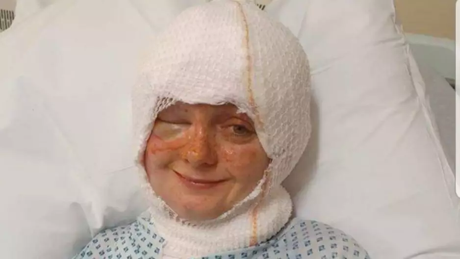 Woman Suffers Severe Burns To Face As Her Hair Sets Alight Blowing Out Candle