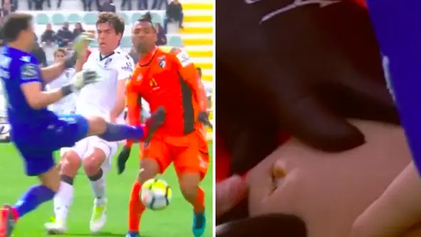 Goalkeeper Gets Red Card For Challenge Which Took A Chunk Out Of Striker's Leg
