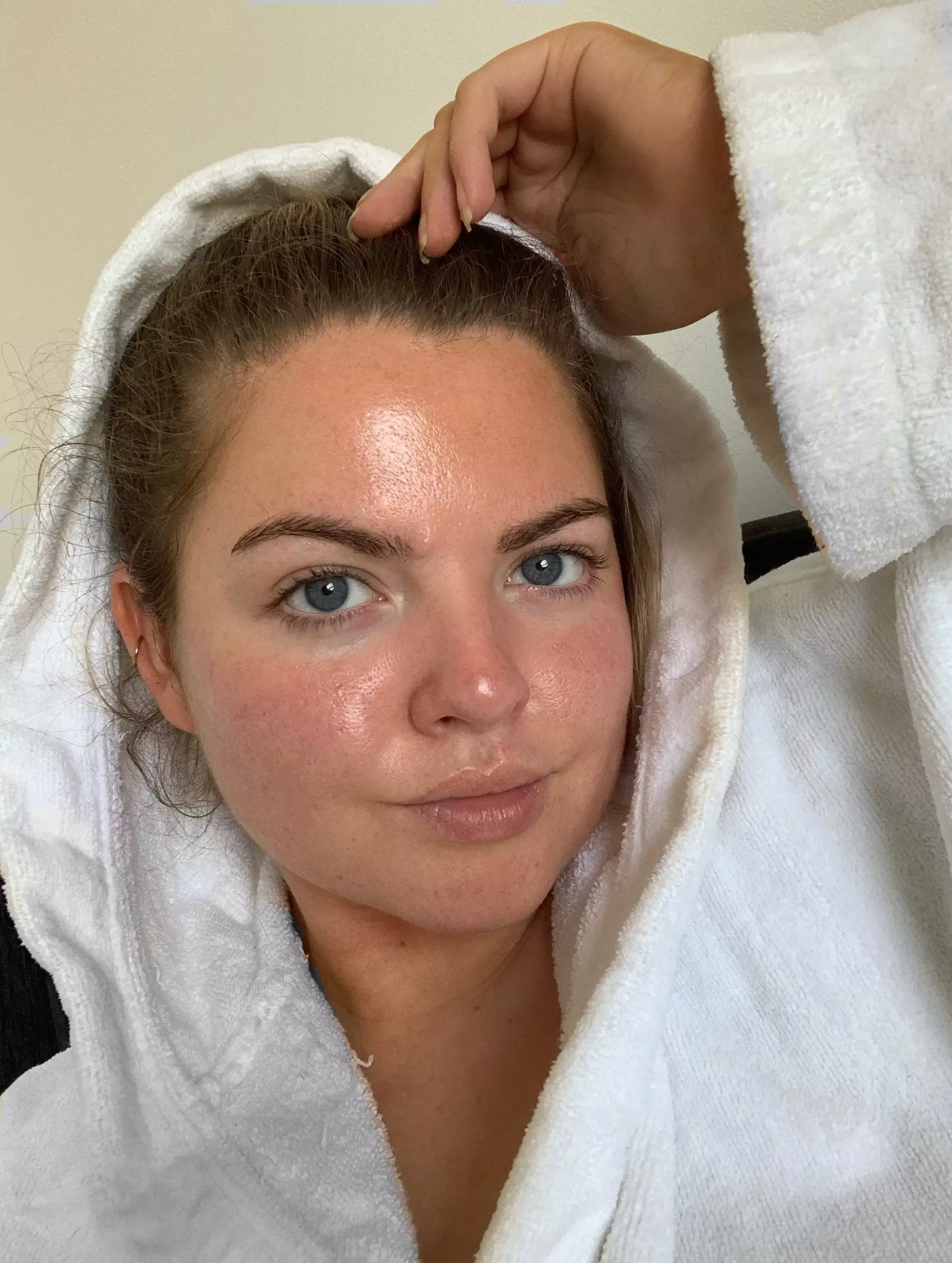 Vanessa is learning to love her skin (