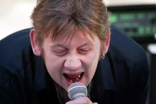 The Love Hate Relationship Between Shane MacGowan And His Teeth