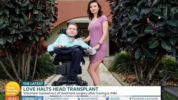 Man Who Agreed To Head Transplant Put Off By New Wife And Baby