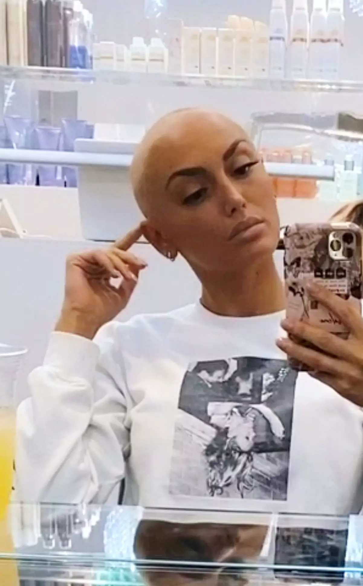 Reality star ZaraLena Jackson opened up about the condition (