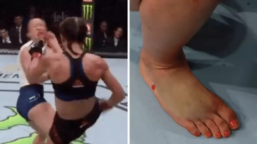 UFC Fighter Joanna Jedrzejczyk Suffers Broken Foot And Somehow Manages To Carry On And Win