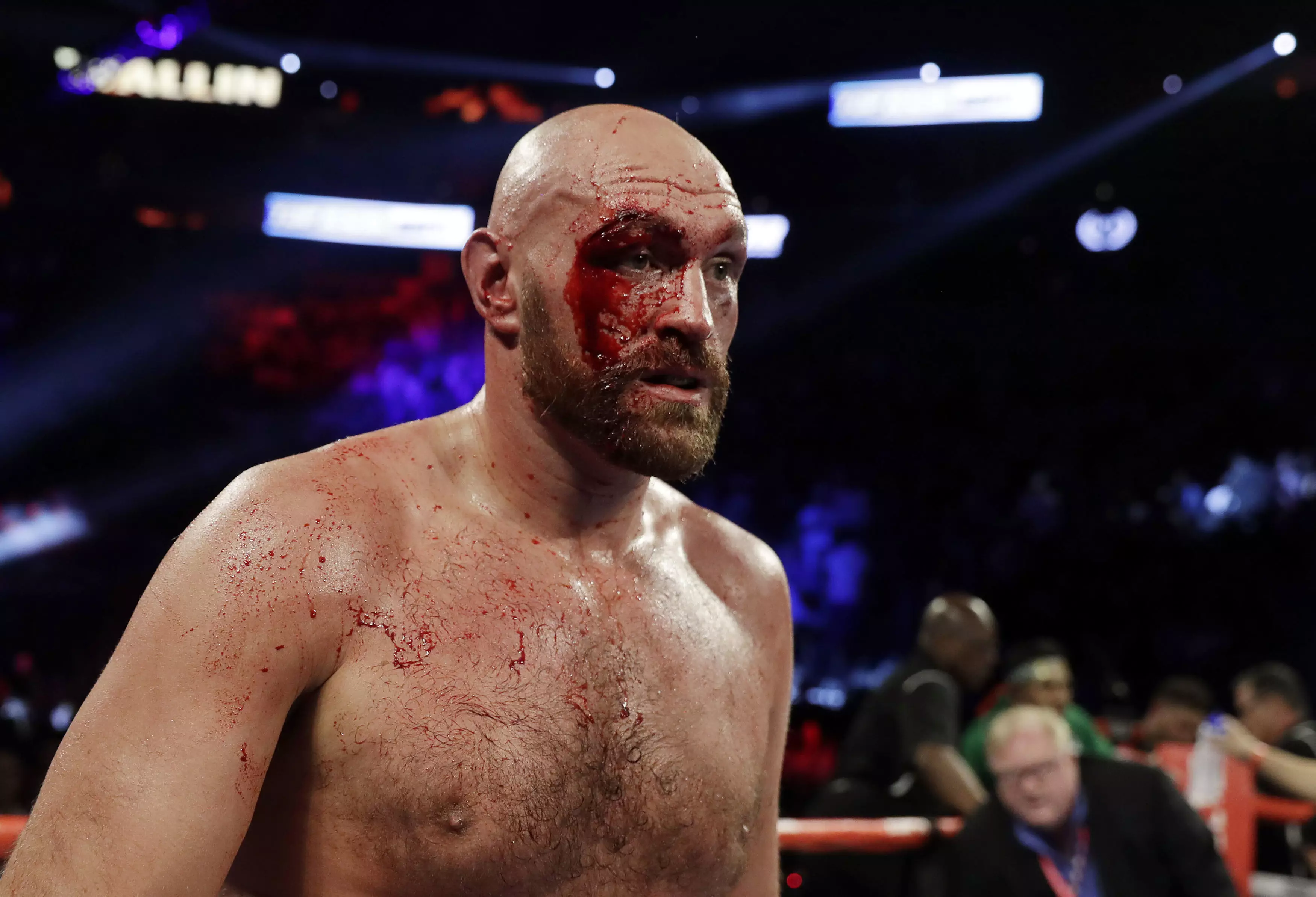 Tyson Fury suffered a huge cut above his right eye against Otto Wallin
