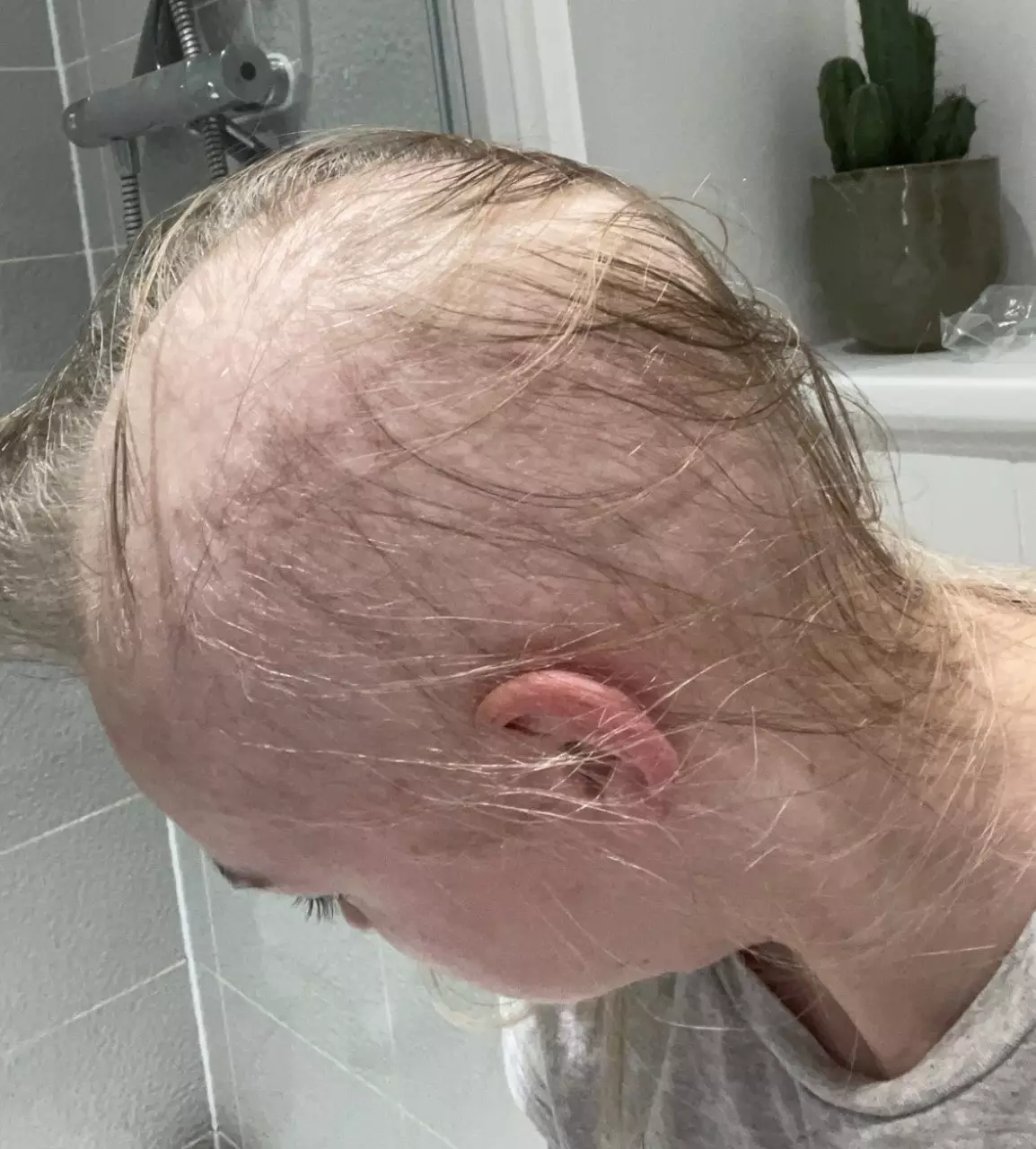 Sophie only had wispy strands before shaving her head (