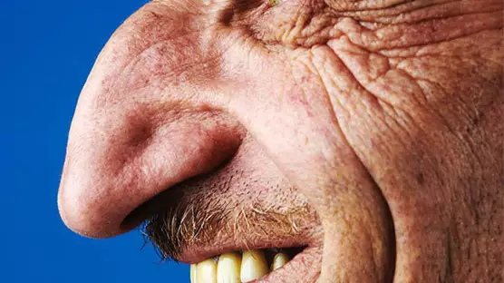 Turkish Man Mehmet Özyürek Has The World's Largest Nose On A Living Person 
