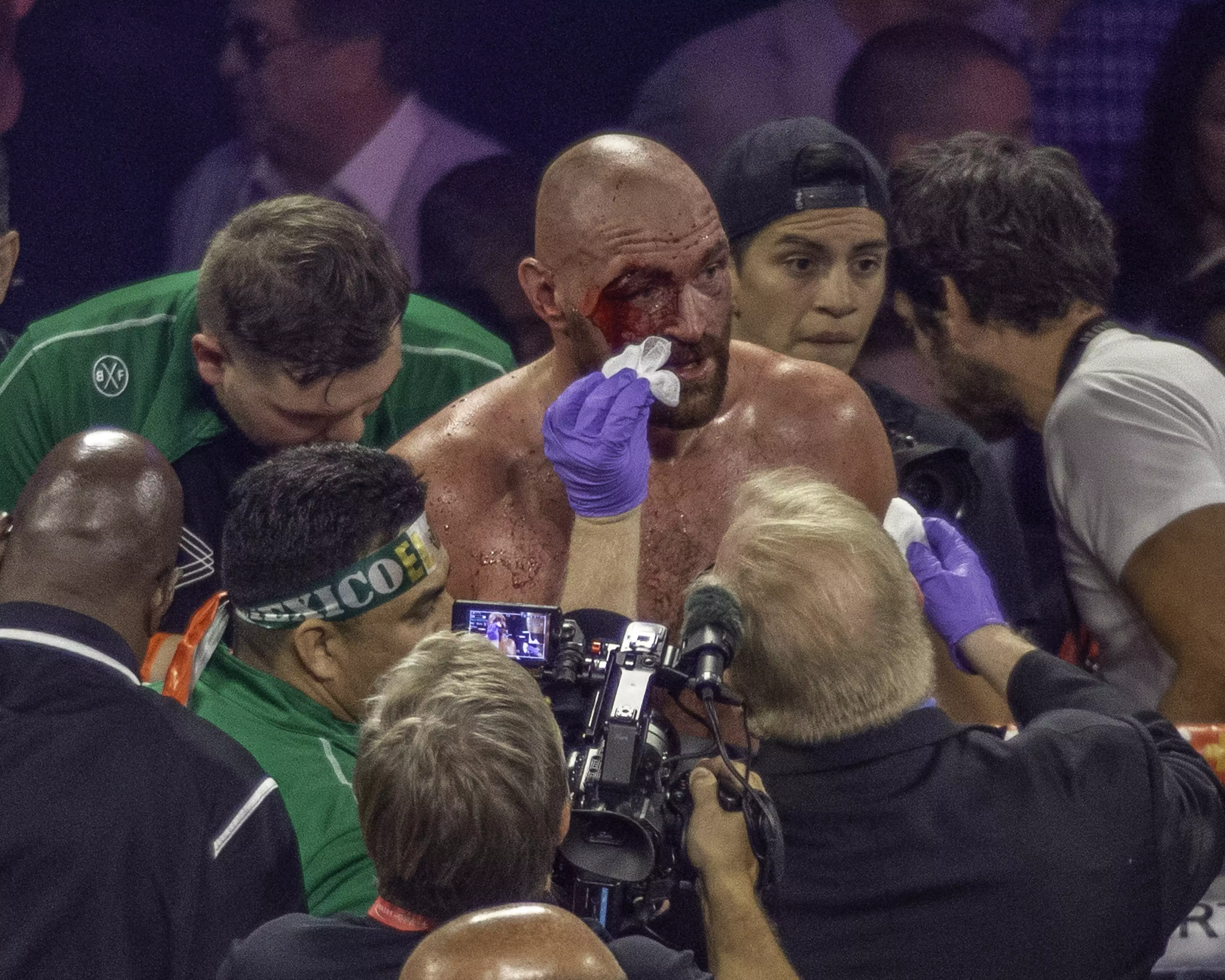 Fury's nasty cut after beating Wallin. Image: PA Images