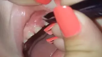 Mum Pulls 27 Fingernails From the Gums Of Her Son
