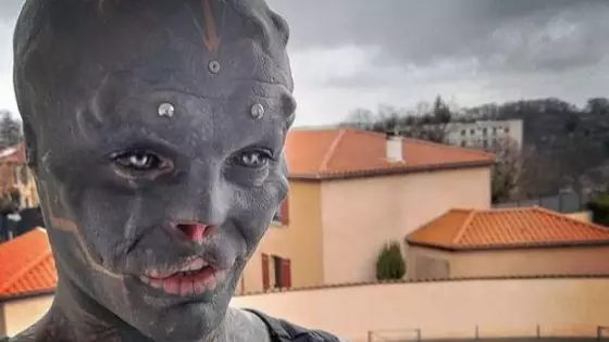 Man Who Had Nose And Top Lip Removed To Look Like A 'Black Alien' Struggles To Speak