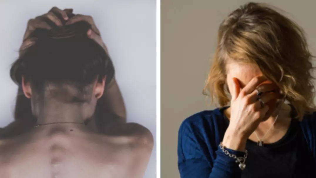 ​Scientists Have Discovered Why Women Get Migraines More Than Men
