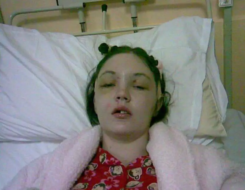 Gráinne Kealy underwent a gruelling 10-and-a-half hour surgery after the smash.