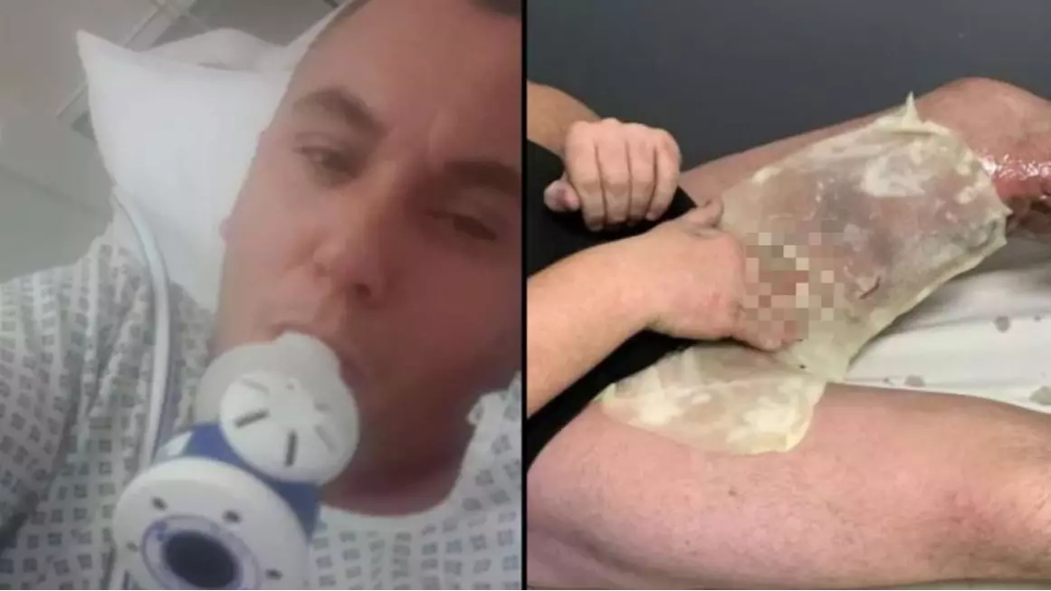 Man Almost Had His Balls Blown Off When E-Cig Exploded