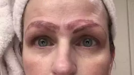 Woman Left With Four Eyebrows Following Botched Microblading Treatment 