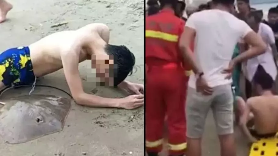Man Gets Penis Stung By Stringray When Swimming In The Sea