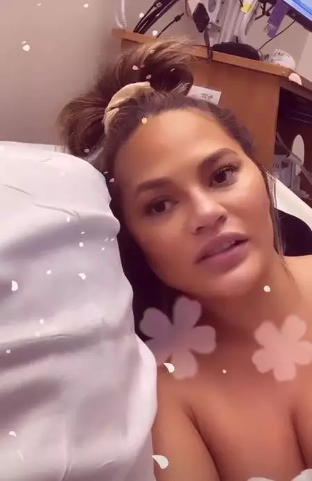 Chrissy Teigen was rushed to hospital due to bleeding.