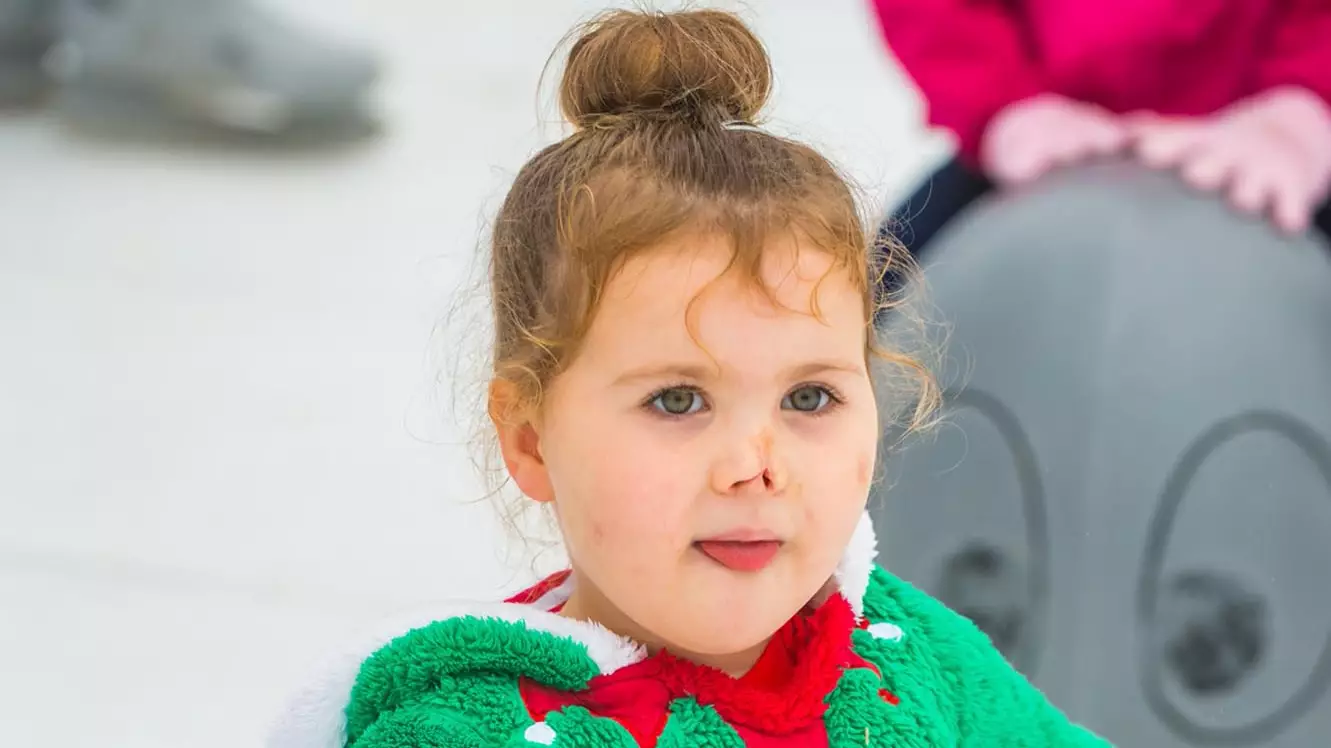 ​Little Girl Who Lost Both Arms And Legs Enjoys A Bit Of Festive Ice Skating