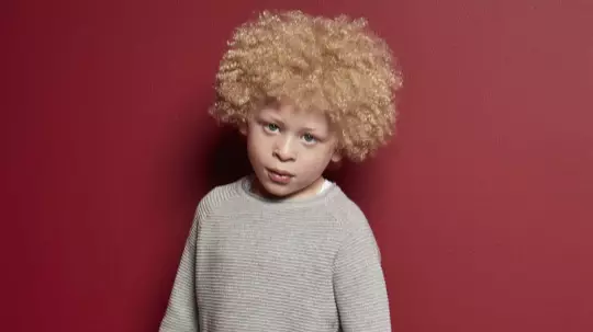 Inspirational Five-Year-Old With Albinism Becomes Face Of Primark's Kids Range