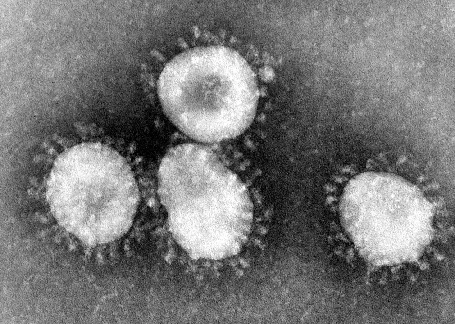 The coronavirus under an electron microscope.