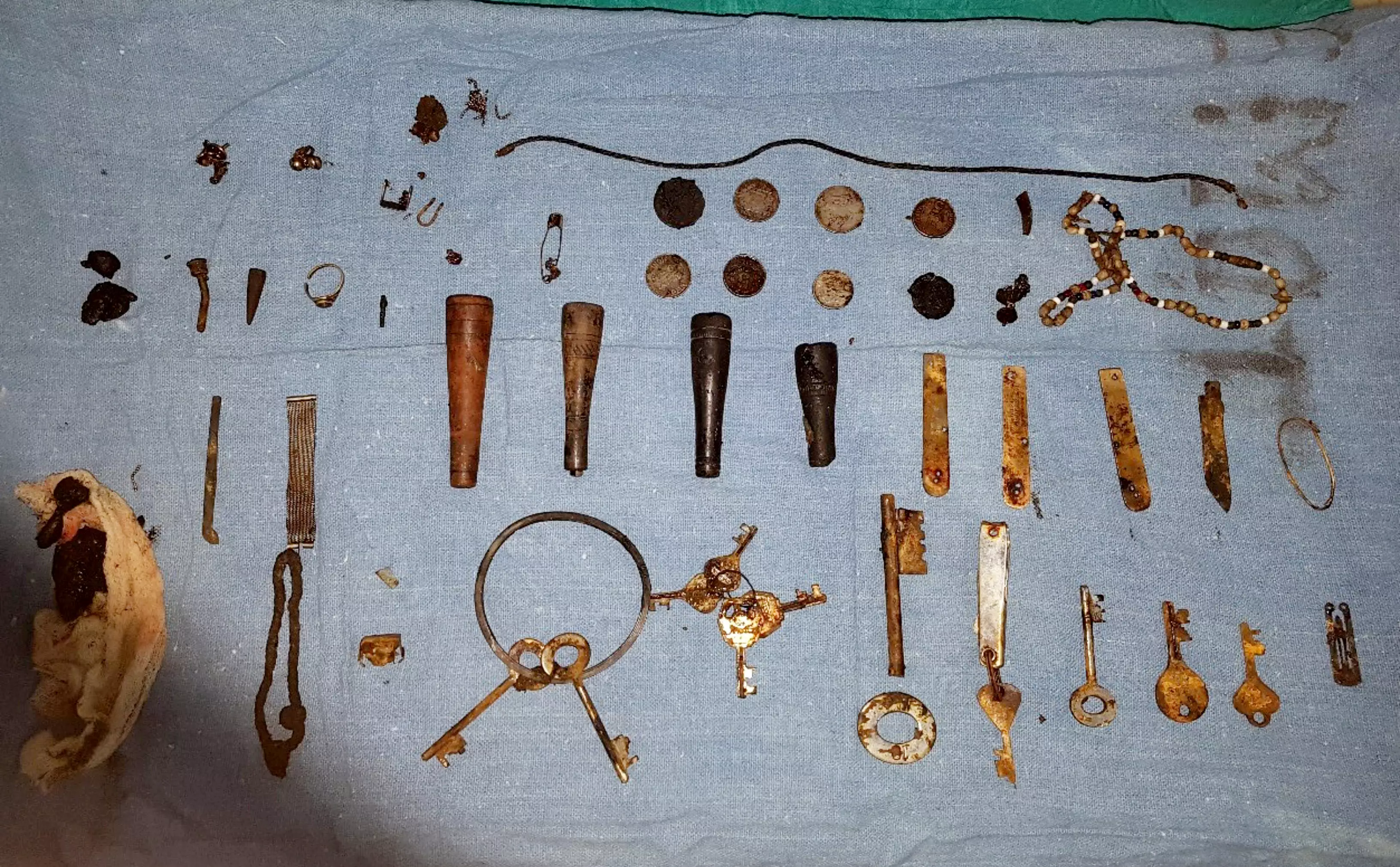 The bizarre haul included coins, knives and keys.