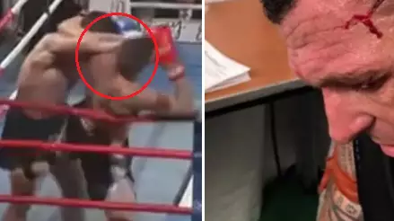 Muay Thai Fighter Suffers Gruesome And Shocking Cut To His Head