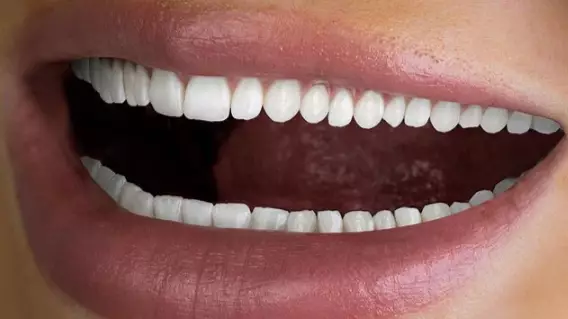 People Are Freaking Out Over ‘Creepy’ Tooth Whitening Advert And We Can’t Unsee It