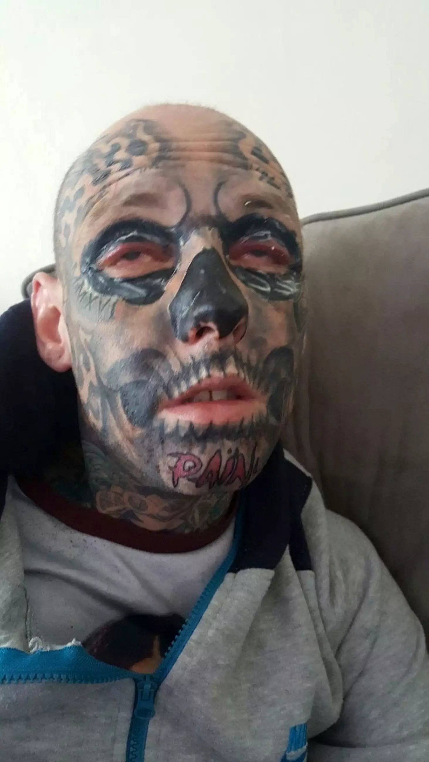His eyelid tattoos left Chris 'blind for three days'.