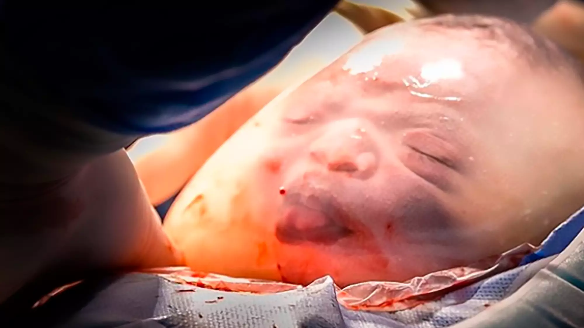Incredible Images Show Baby Born Inside Amniotic Sac 