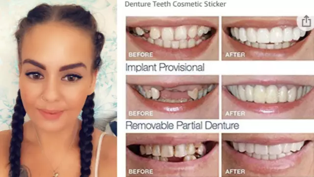 Woman Is Left In Hysterics After Buying £3 Clip-On Veneers