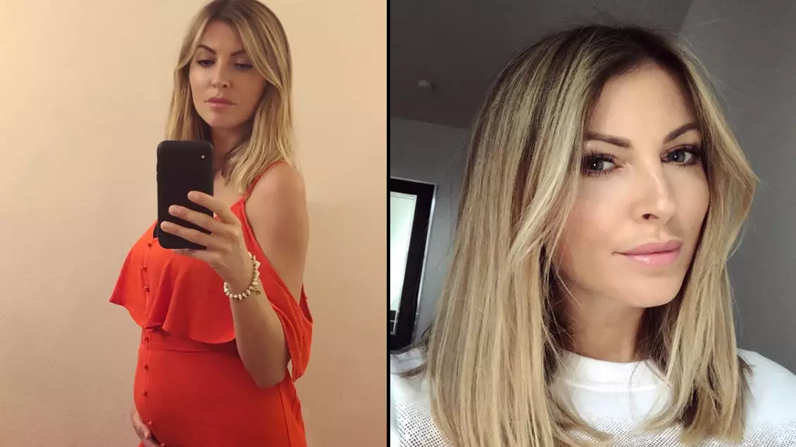 Former Model Sam Smalling Opens Up About Living With Condition That 'Makes Her Look Pregnant' 