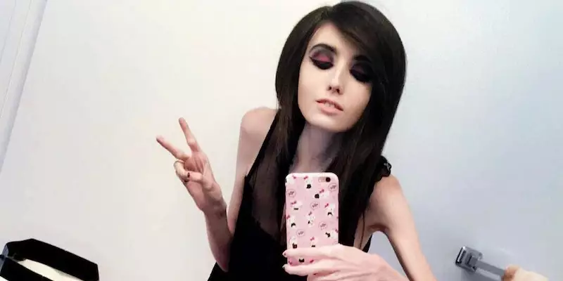Petition Claims 'Anorexic' Vlogger Should Be 'Banned From YouTube'