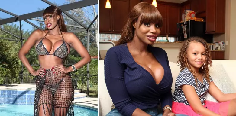 'World's Most Successful Sugar Baby' Has $100,000s Worth Of Surgery To Look Like Jessica Rabbit