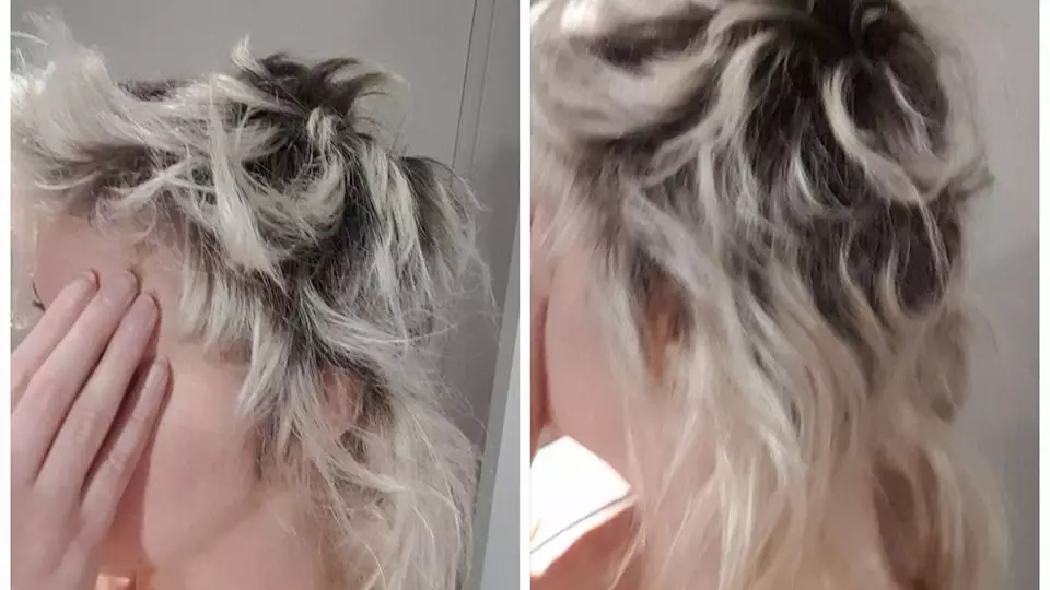 Woman Demands £16,000 Compensation After Bad Bleach Job Made Her Hair Fall Out