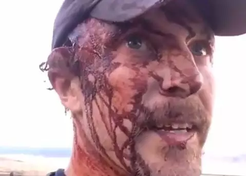 Man Films Aftermath Of Horrific Grizzly Bear Attack