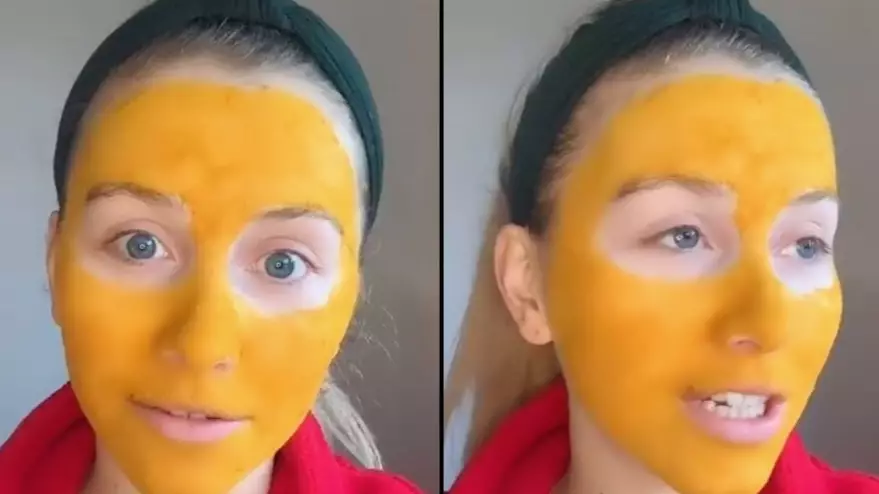 Woman's Face Stays Orange For Days After Wearing Turmeric Face Mask