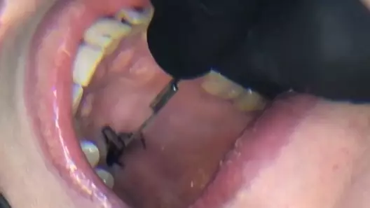 People Are Getting NSFW Tattoos In Their Mouths 