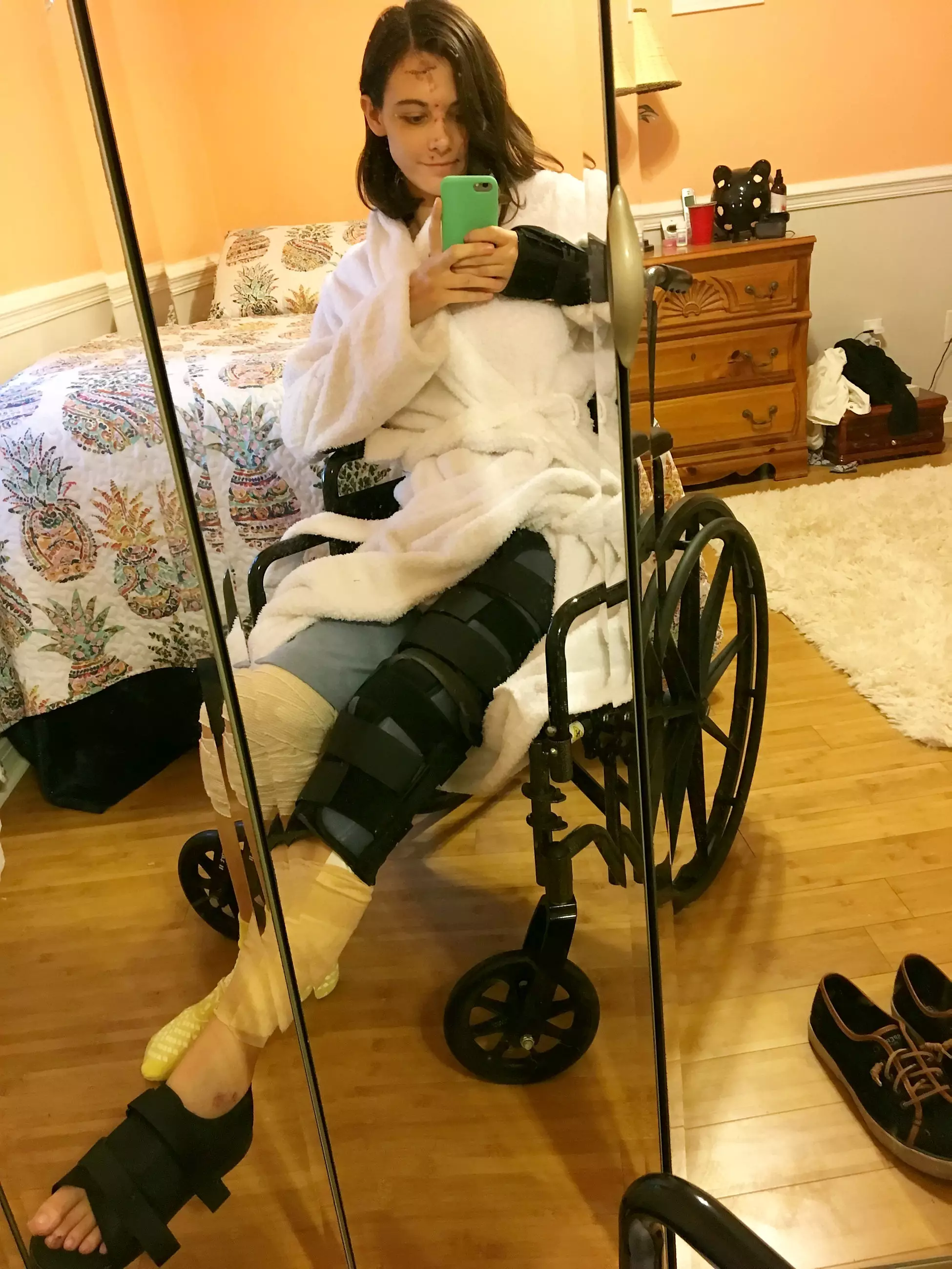 Megan is now recovering in a wheelchair, while she swears off drinking for life. (