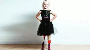 Model, 7, Who Is Double Amputee Hired By River Island 