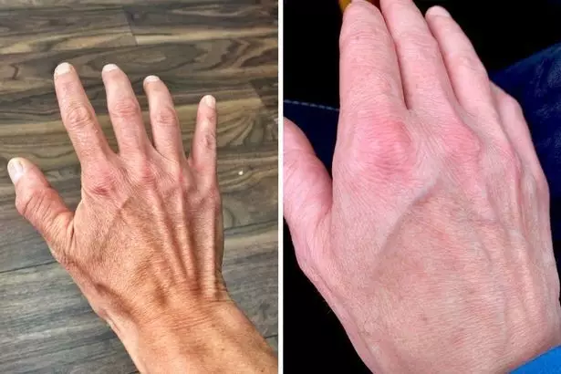 Roweena claims her hands have 'changed shape'.