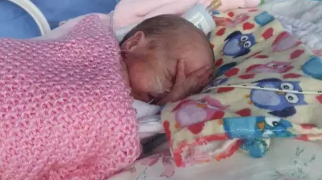 Premature Baby Born 17 Weeks Early And Weighing 1Ib Leaves Hospital